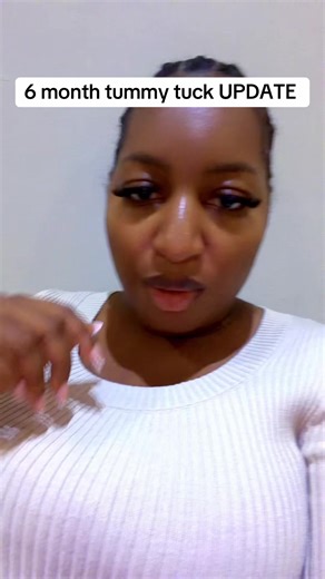 6 Month Tummy Tuck Update: Healing and Future Plans