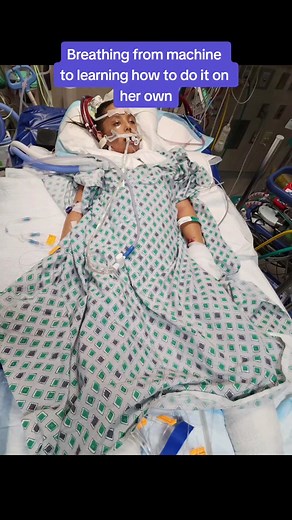 Mia started out in a medical coma having a machine breathe for her to learning to breathe on her own. In the last clip you can see she struggled to breathe. Her airways seem to collapse when she inhales through nose and mouth. They are going to have to do an exploratory bronchial scope. prayers and donations are welcomed. #Breathe #BreathIsLife #Air #amputee #summer #ChildrensHospitalOfPhiladelphia #Healing4Mia2023 #physicaltherapy #Stroke #Survivor #xyzbca #rehab #fyp #mia #BackToDecember
