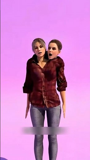 Unbelievable Human Conditions: The Inspiring Lives of Conjoined Twins 3d Animation video short