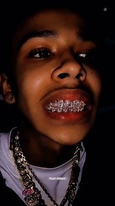 Man With Diamond Teeth 🦷 #facts #knowledge #amazingfacts | Fact Albert