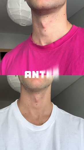 Cómo arreglar el cuello desbocado de una camiseta