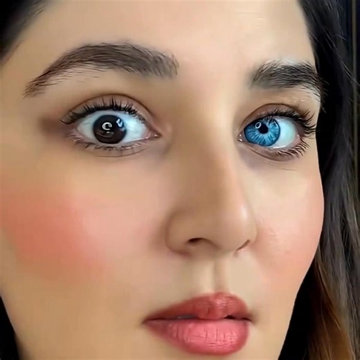 91 reactions · 5 comments | ️Eye Drops: Change Your Eye Color in...