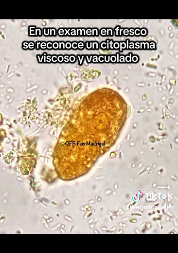 Trofozoitos de Entamoeba coli: Características y Diagnóstico
