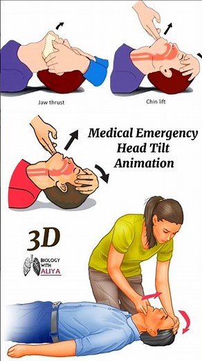 Medical Emergency Head Tilt Animation | #3d #short | Learn Biology with Aliya