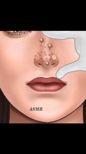ASMR Endoscopic Nose Secretion Removal Animation / Piercing nose full of boogers! | ASMR