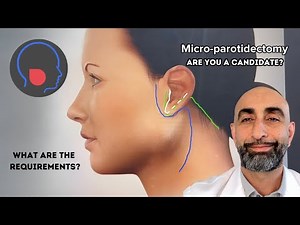 Are you a candidate for a micro-parotidectomy surgery?