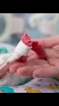 Story of the 30 weeks Preterm