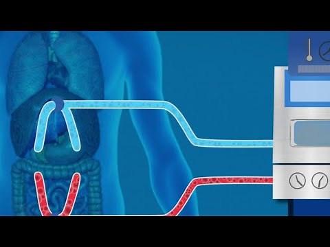 Good Health: The advancement of the Hipec procedure