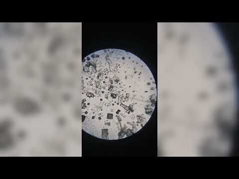 Determination of particle size, particle size distribution using microscopic method #microscope
