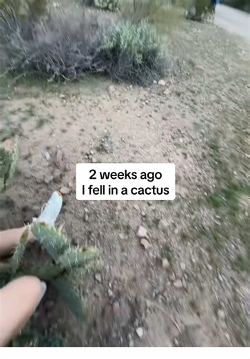 reposting b/c it’s officially been 2 weeks since I learned situational awareness the hard way (also I had to get surgery to remove an embedded needle) This video is being represented by LADbible Group. For any usage/licensing requests, please email licensing@ladbiblegroup.com #tucson #tucsonarizona #tucsonaz #universityofarizona #arizona