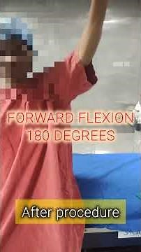 FROZEN SHOULDER - ULTRASOUND GUIDED HYDRODILATATION