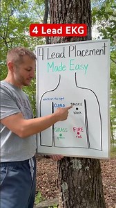 4 lead ekg placement made easy. #nursing #nursingstudent #paramedictorn #emtb #ernurse