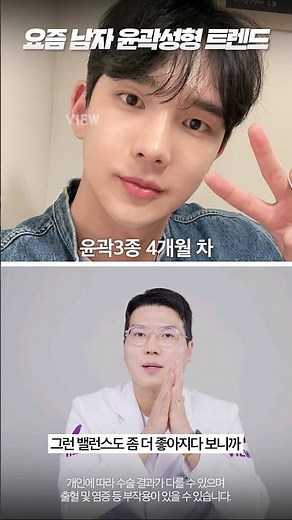[윤곽수술] 남자 윤곽3종 레전드