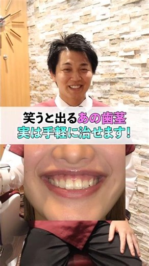 笑ったら歯茎が見える「ガミースマイル」実は手軽に治療できるんです！