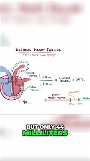 Systolic Heart Failure Understanding Ejection
