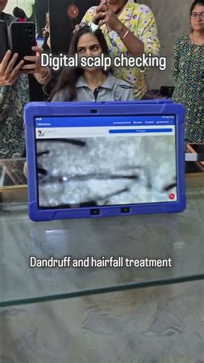 What Dandruff REALLY Looks Like Up Close 🔬😱 #Shorts #ViralShorts #HairCareRoutine #DandruffTreatment