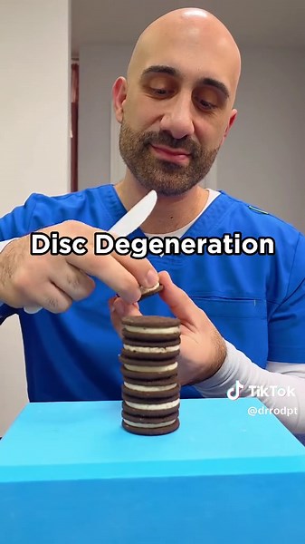 Spinal Deformities Explained 🎥 Video by Dr. Rodion Narkolayev 🏅 Board Certified Physical Therapist 💪 Certified Advanced Manual Therapist 📧 Email: hello@truebodypt.com 📍 Address: 65-36 99th Street, Suite #1D Rego Park, New York 11374 📞 Phone: 718-897-6869 917-886-5667 ⚠ Disclaimer: This video is for educational purposes only and does not replace professional medical advice. If you experience pain or have a medical condition, please consult a qualified healthcare professional before trying a