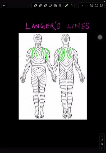 Why Some Surgical Scars Always Widen l Skin Incision MCQ