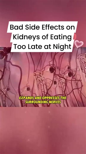 1.3M views · 9.5K reactions | Bad Side Effects on Kidneys of Eating Too Late at Night #KidneyHealth #health #awareness | Mommy Che | Facebook
