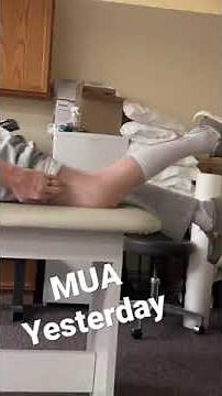 MUA Yesterday | Total Knee Replacement