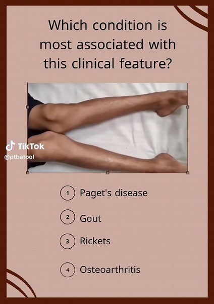 Understanding Physiotherapy Techniques Explained