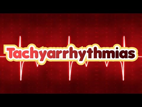 Tachyarrhythmias (updated 2023) - CRASH! Medical Review Series