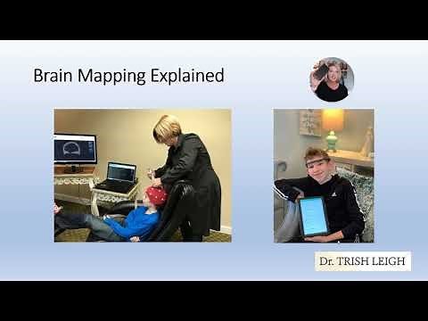 How Does Brain Mapping Work?