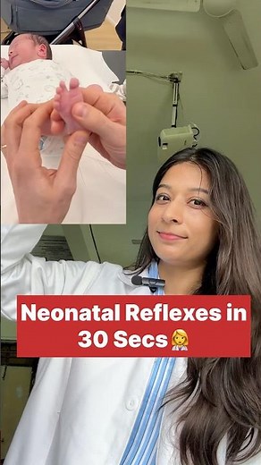Neonatal reflexes in 30 secs #neet #neetpg #neonates #anatomy #anatomy