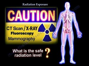 Radiation Exposure Radiation safety-Everything You Need To Know #radiation