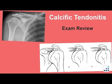 Calcific Tendonitis Exam Review - Jay Keener, MD