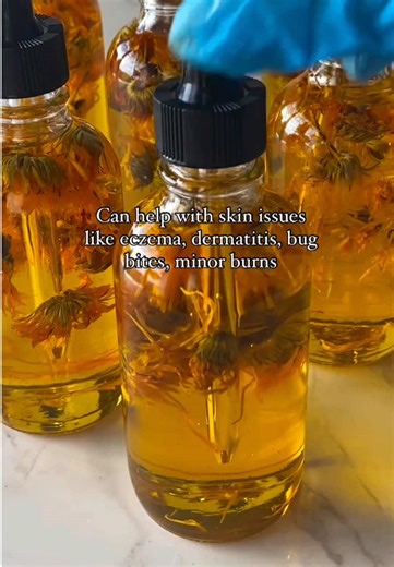 Pure Calendula Oil for Eczema Relief and Skin Care