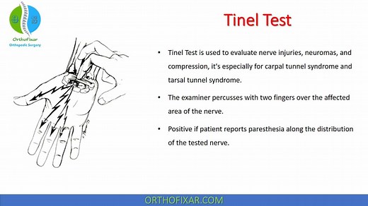 Tinel Test Overview Explained Easily | OrthoFixar