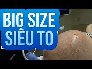 Parto Normal || raw & real || Labor and Delivery Vlog || o nascimento do duong || BIRTH VLOG