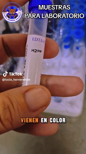 Colores de los tubos para muestras de laboratorio