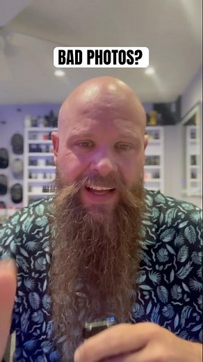 Why Your Bald Head Looks Uneven in Photos