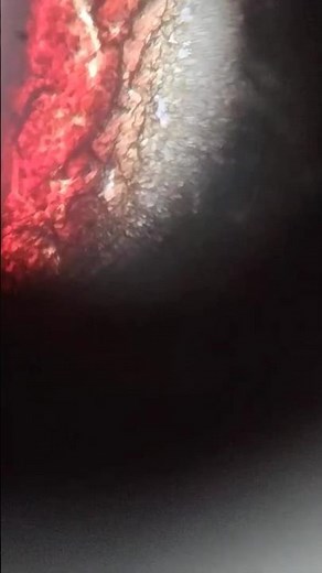 Blood cells under compound microscope