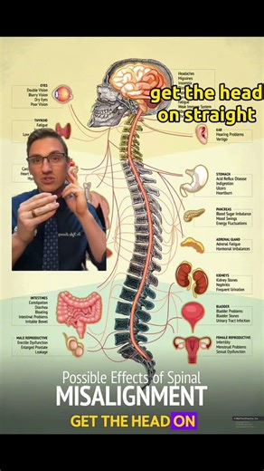 Spinal Misalignment