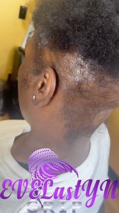1M views · 59K reactions | https://evelastyngrip.com/ IM LOCATED IN MARIETTA GEORGIA https://evelastyngrip.com/(Cover up style ) 羅殺 #alopecia braider #alopeciaareataawareness #alopeciatreatment #braidstyles #alopecia #coverupbraids #hairrestoration #hairdresser | Evelyn West | Facebook