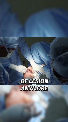 Prepping the shoulder socket (glenoid) for bone graft placement...