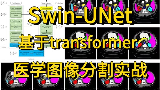 毕设有救了！基于Swin-UNet模型的【医学图像分割实战】，论文解读 源码复现，AI大佬手把手带你1小时吃透图像分割实战，看完即跑通。比刷剧还爽！-AI