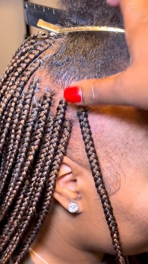 Must Watch! My client has hair loss around her edges but still wanted box braids. Watch how I seamlessly blended it so well that you can barely tell! 🔥 If you're experiencing the same issue but love braids, save this and show it to your stylist! You can still rock the style you love. #braids #braidsbytiara | Braidsby tiara