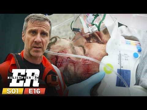 Severe Head Trauma Alert | Helicopter Er Season 1 Episode 16