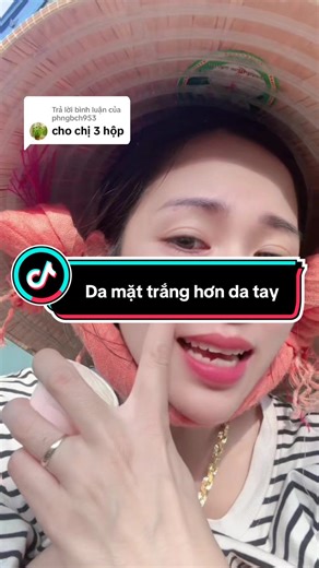 Kem Trị Nám và Tàn Nhang Hiệu Quả Nhất