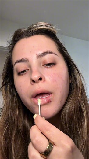 Lip Clear Lysine relieves cold sore pain fast.⏱️ Protect and heal with our bandage. Get your bundle & save 10% now! | Quantum Health Products