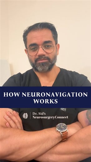 Dr. Sid’s Neurosurgery Connect on Instagram: "👨🏻‍⚕️Neuronavigation has revolutionised modern brain and spine surgery — but it’s not a replacement for surgical skill. It’s a powerful tool that enhances precision, safety, and planning by giving surgeons real-time 3D guidance based on MRI and CT scans. 🧠 What Neuronavigation Does: • Offers GPS-like accuracy inside the brain • Helps identify tumors, vascular lesions & critical pathways • Allows millimeter-level planning and safer surgical traject