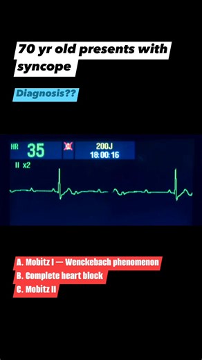 #ECG #ecgchallenge #cardiology #fblifestyle | Medicine for all