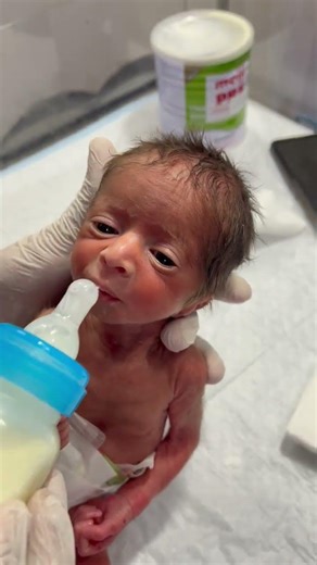 Very Critical Newborn Shows Little Improvement | Taking Formula Feeding | A Unique NICU Case