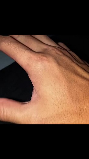 #CapCut .. hand muscle #handmuscledeveloper #muscle #toproll #armworkoutathome #typeeeeeeeeeeeeeeeeeeeeeeeeeeeeeeeeeeee #trending