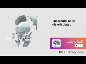 Frontal Bone - Disarticulated