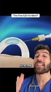 “First IUD for Men”? #promising